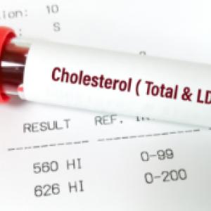 Private Cholesterol Test in London – Fast, Accurate & Confidential Results