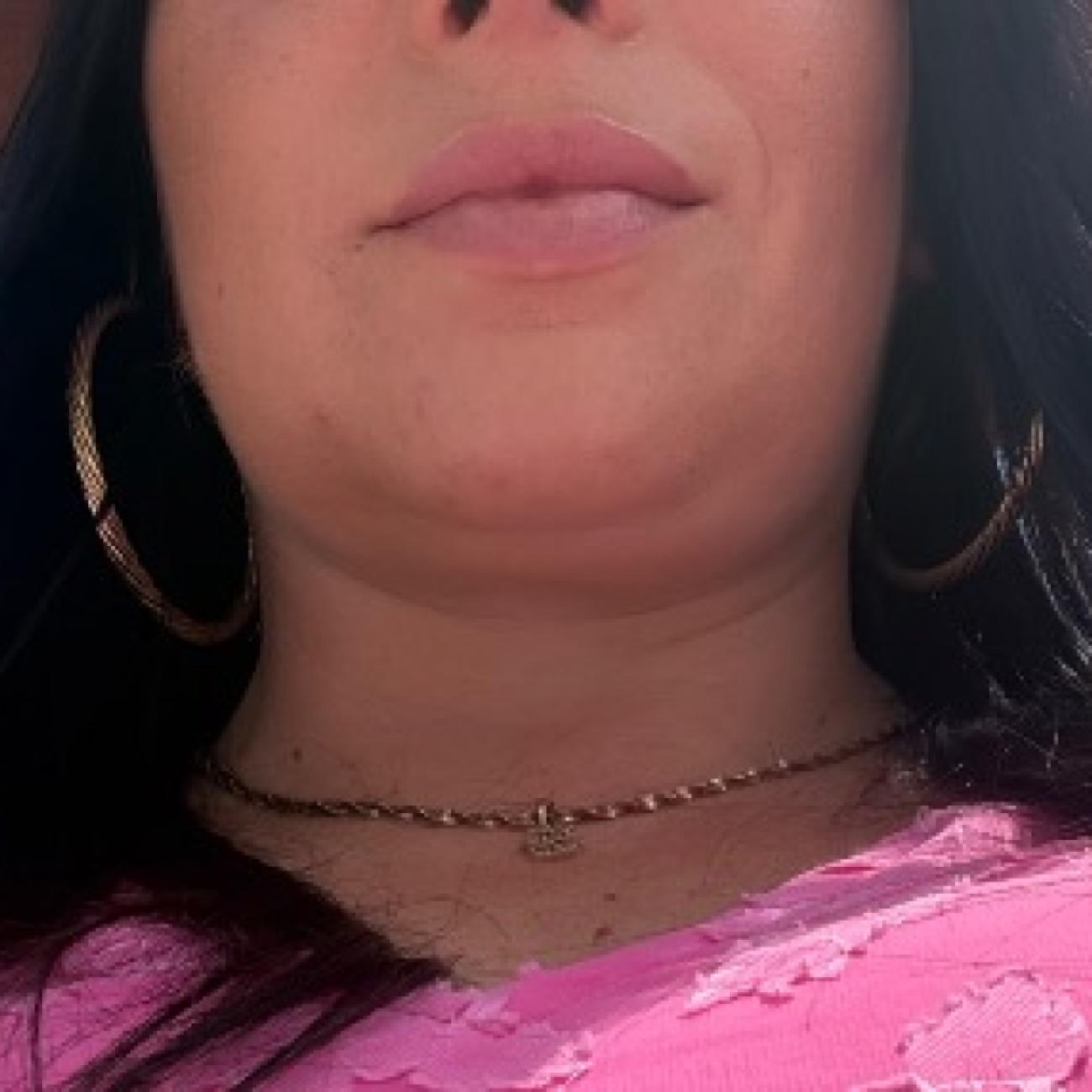 ✨ Elegant & Discreet Escort ✨